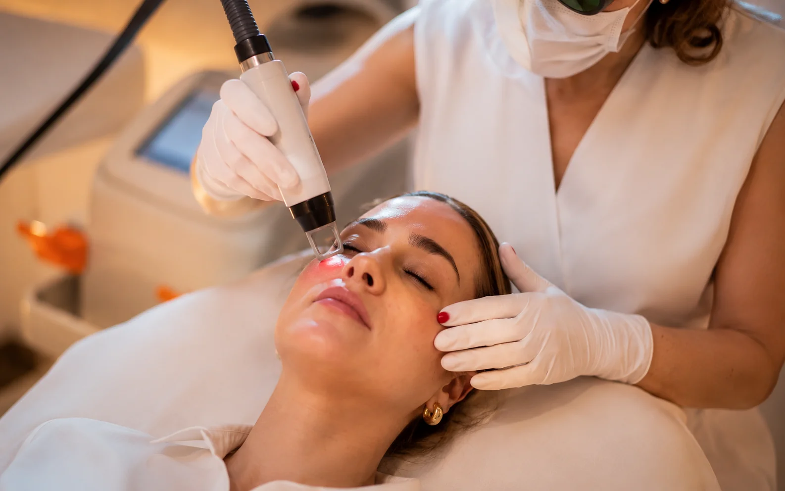 Laser Facial — Klinicá Dermatologia, Barra da Tijuca