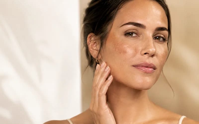Programa Intensivo para Controle do Melasma — Klinicá Dermatologia, Barra da Tijuca